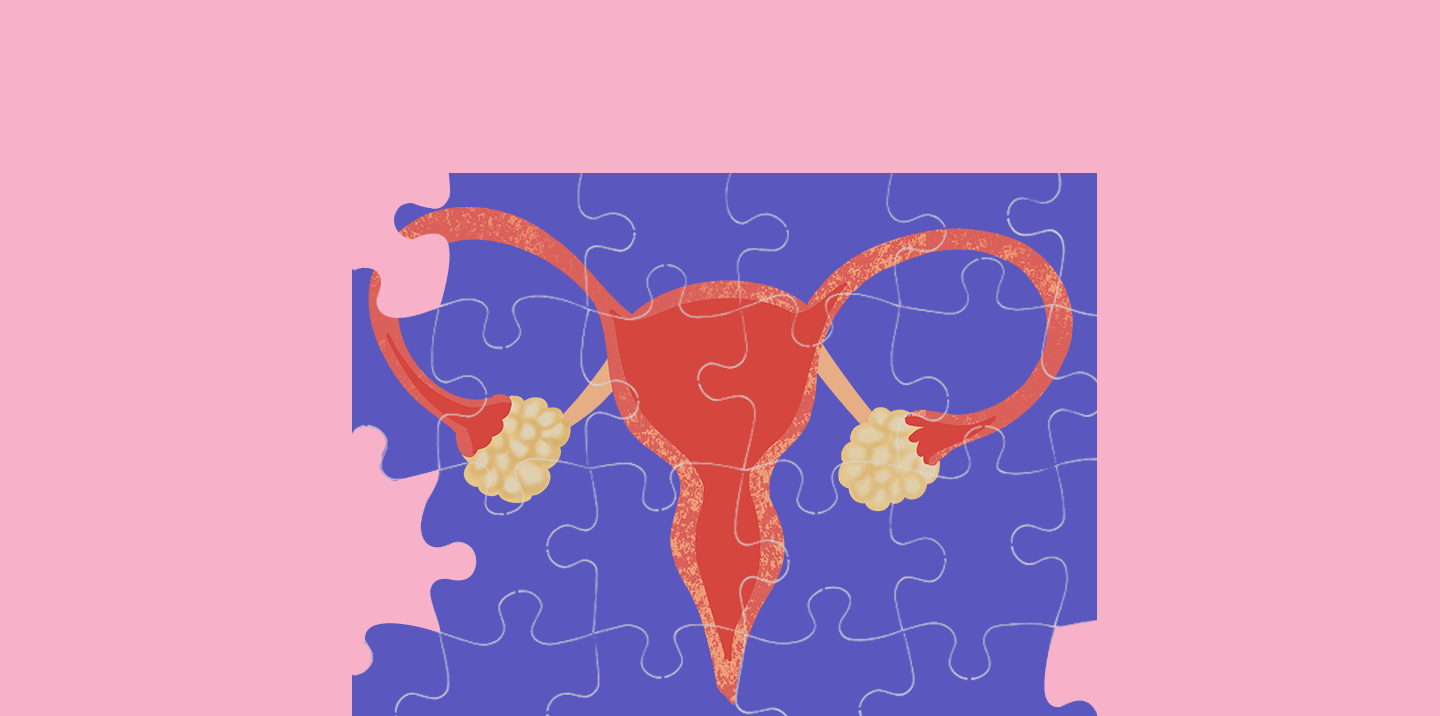 The PCOS Puzzle